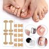 Professional Ingrown Toenail Corrector – Foot Care Stickers for Nail Protection and Paronychia Treatment