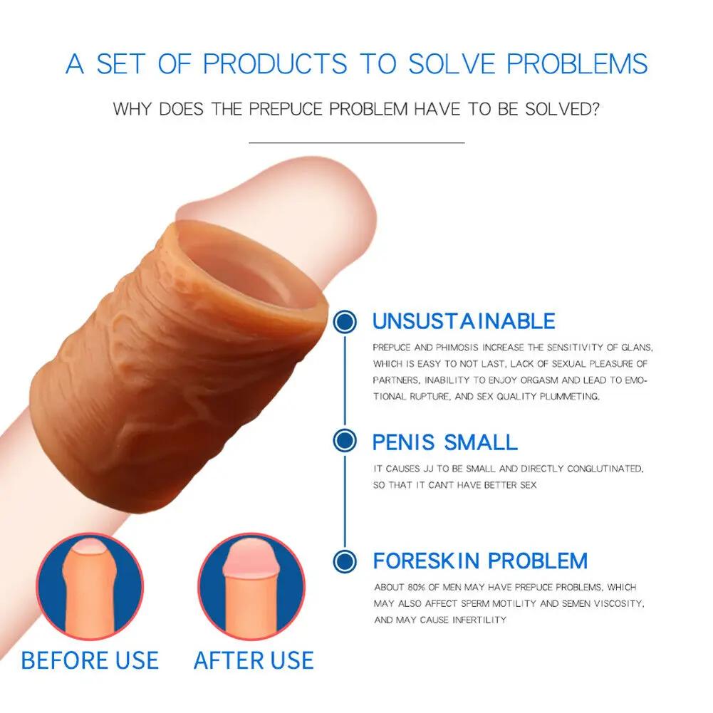 3 Types Foreskin Restoration Correction Penis Rings Delay Ejaculation Sex Toys For Men Reusable Cock Ring Men's Ring Corrector