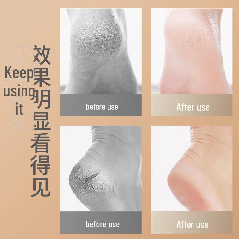 Silicone Heel Protection Socks for Women - Moisturizing and Anti-Cracking Foot Care