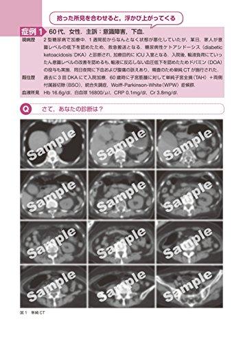 Imaging Diagnosis for Diseases and Pathology: Abdominal Emergency Diseases (Otsu Imaging Conference)