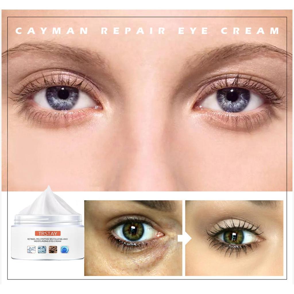 Intensive Eye Cream For Wrinkle Reduction And Deep Moisturization