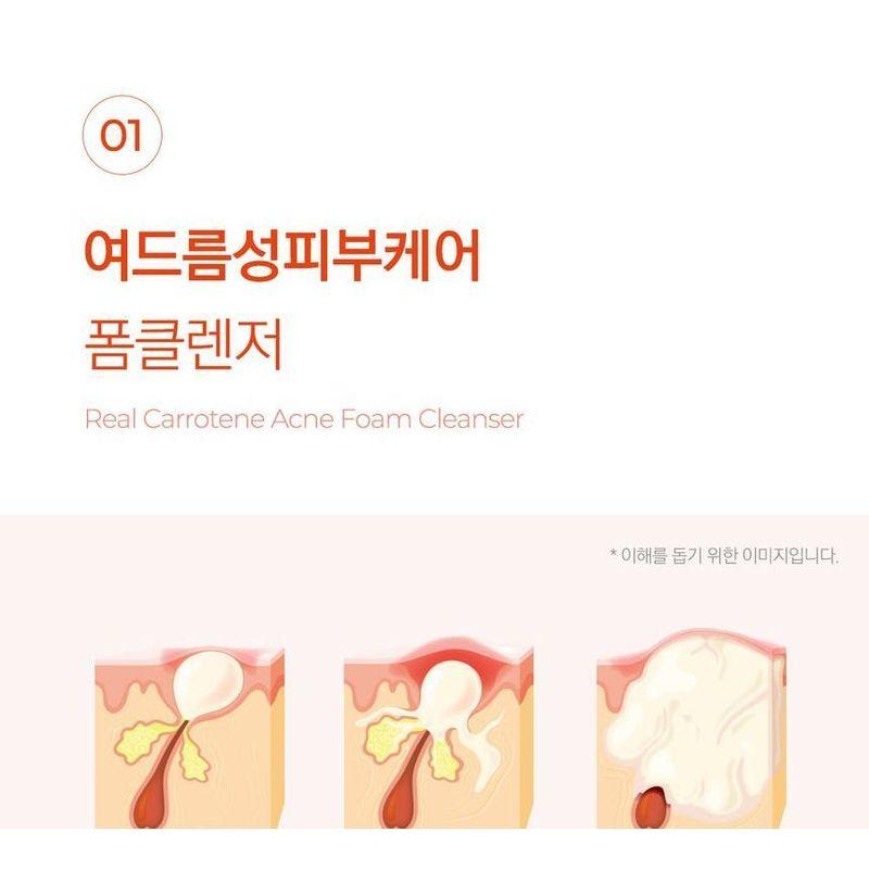 Aprilskin Real Carrotene Acne Foam Cleanser