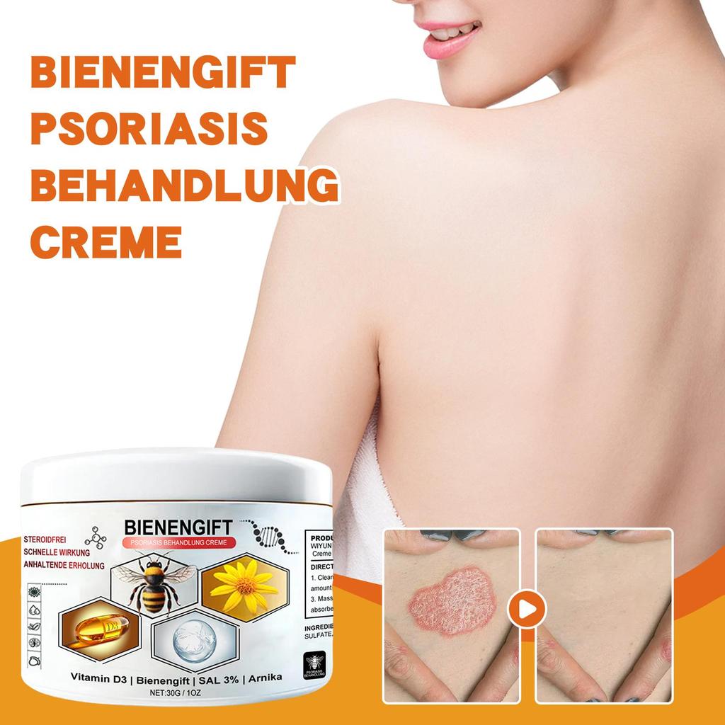 30g Bee Venom Body Cream Body Skin Nourishing Moisturizing Discomfort Relieving Care Daily Massage Applicator Cream