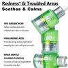 Anua AZELAIC HYALURON SOOTHING SERUM 30ML, Soothing Calming, Hydrating, Improve Texture, Non-Sticky, K-Beauty, Korean Makeup