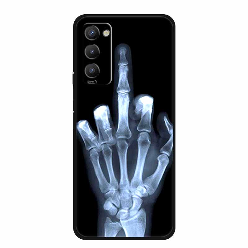 Pour Tecno Camon 18 Coque Dessin Animé Silicone Souple Arrière Housse Pour Tecno Camon 18P Camon 18T 18 P Coque TPU Animal Camon18 Coques