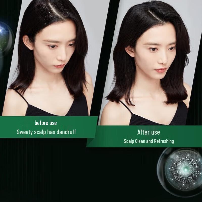 Clear Ice Cool Anti-Dandruff Shampoo