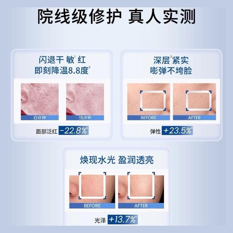 AHC Reverse Hydra B5 Deep Volume 5 Skincare Set,130ml Essence Water+100ml Emulsion+2 Boxes 5pcs B5 Repair Facial Mask Total 10 Sheets Hydrating Kit