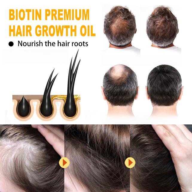 EELHOE Biotin Hair Care Essential Oil Deeply Moisturizes Hair with Scalp Massage Care, Supple and Shiny Daily Hair Care Products 30ml