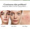 Retinol Wrinkle Face Serum Hyaluronic Acid Pore Shrink Moisturizing Lifting Facial Essence Skin Care Products Beauty