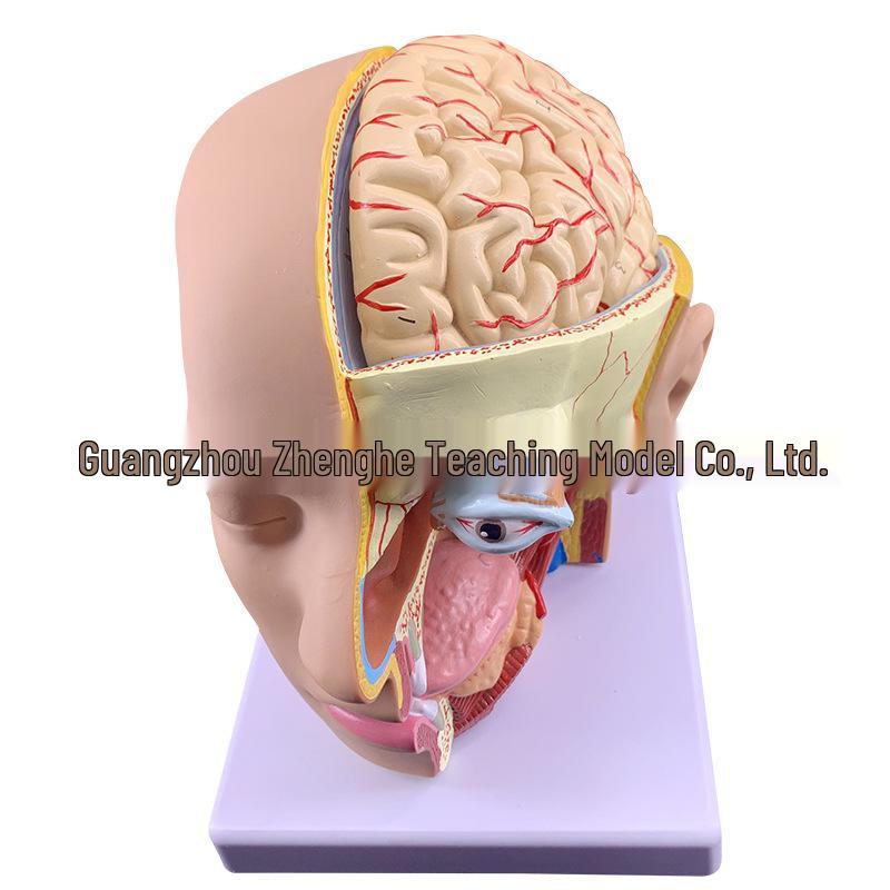 Natural Size Head Anatomy Model with Cerebral Arteries, 4-Part Mid-Sagittal Brain Section