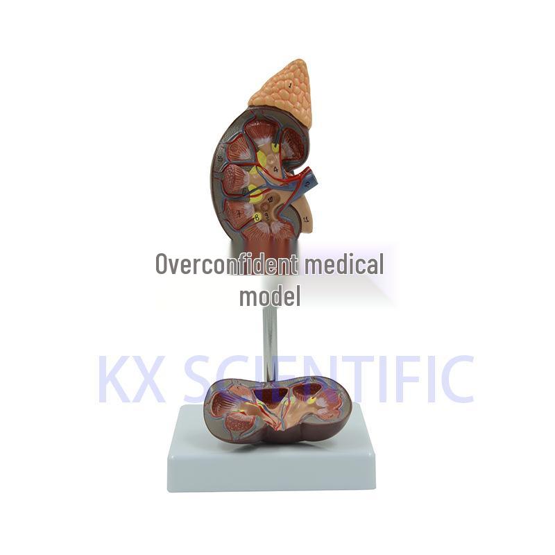 1:1 Human Kidney Model - Detachable Urinary System Anatomy Teaching Aid 11x11x19 cm