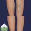 Pulse Vein Varicose Cream Pulse Leg Cream Body Cream Crema Aclaradora De Piel  Skin Whitening Cream Snail Cream Face