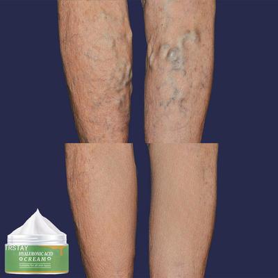 Pulse Vein Krampfader Creme Pulse Bein Creme Körper Creme crema aclaradora de piel haut aufhellung creme schnecke creme gesicht