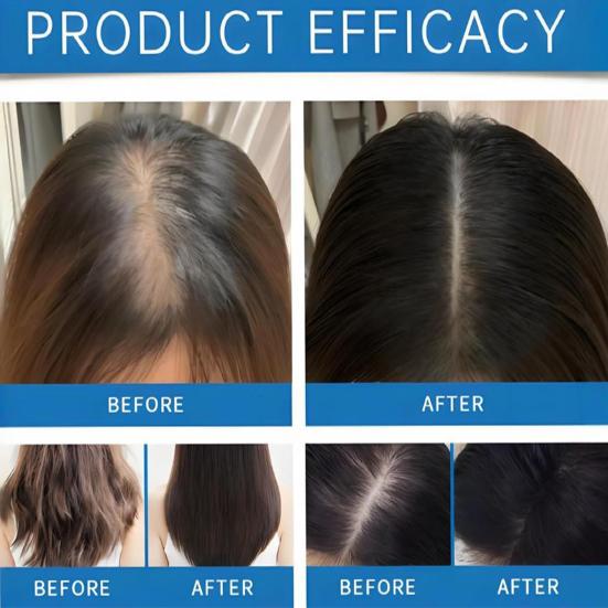 1/2/3Pcs 10ml Hair Care Essential Oil Roller Applicator Prevent Hair Loss Nourish Roots Quick Absorption