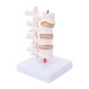 Professional Osteoporosis Model Human Anatomical Spine Model for Teaching Demonstration