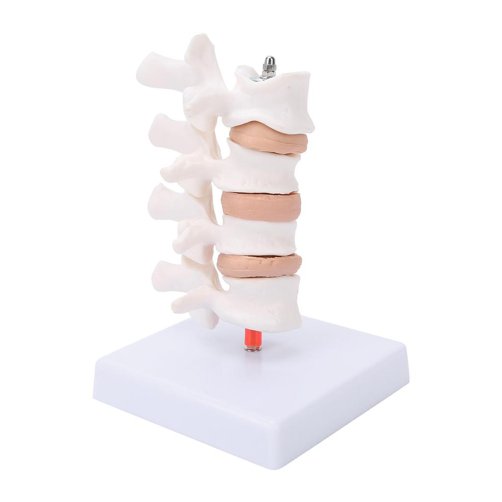 Professional Osteoporosis Model Human Anatomical Spine Model for Teaching Demonstration