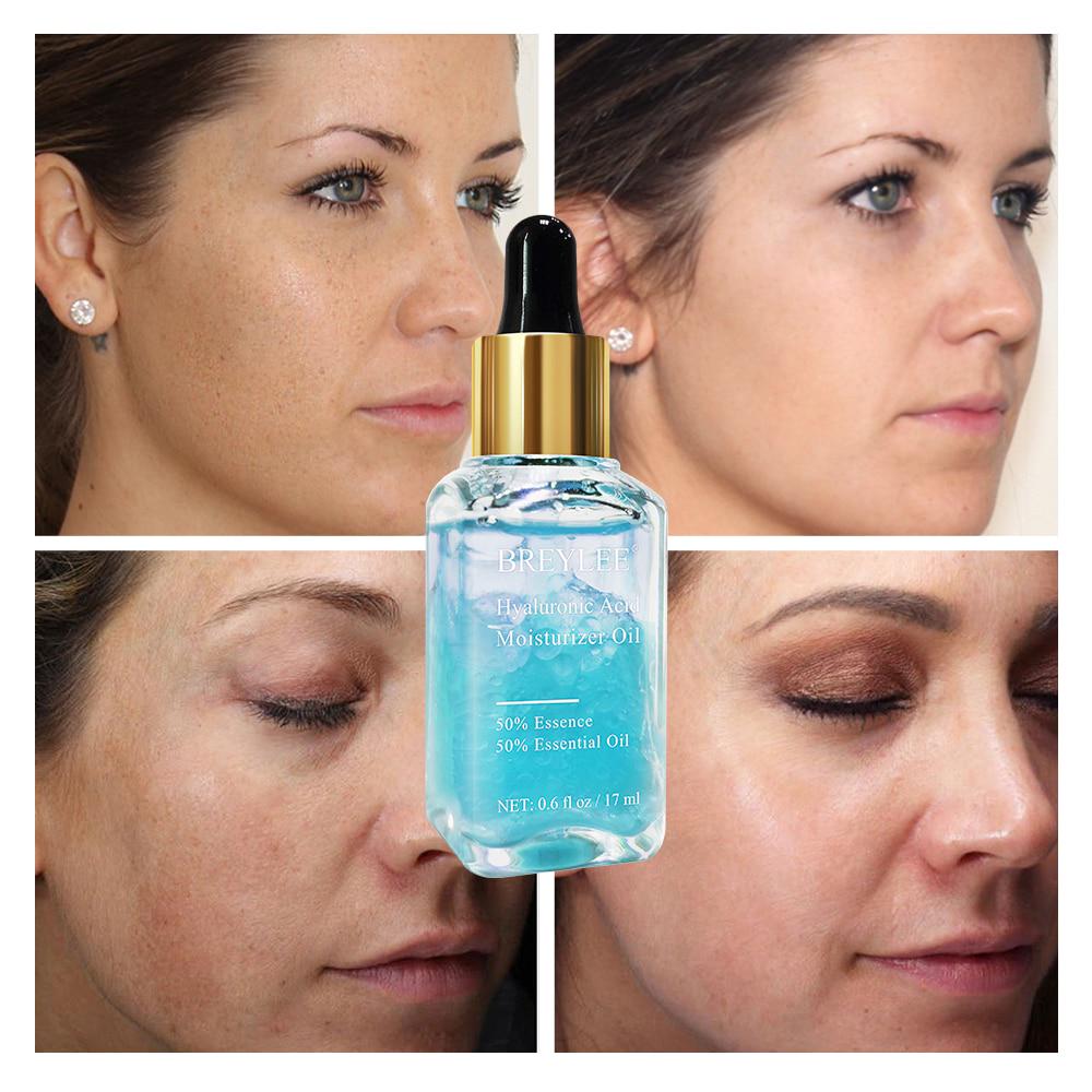 Buy BREYLEE Hyaluronic Acid Essential Oils Moisturizer Nourishing