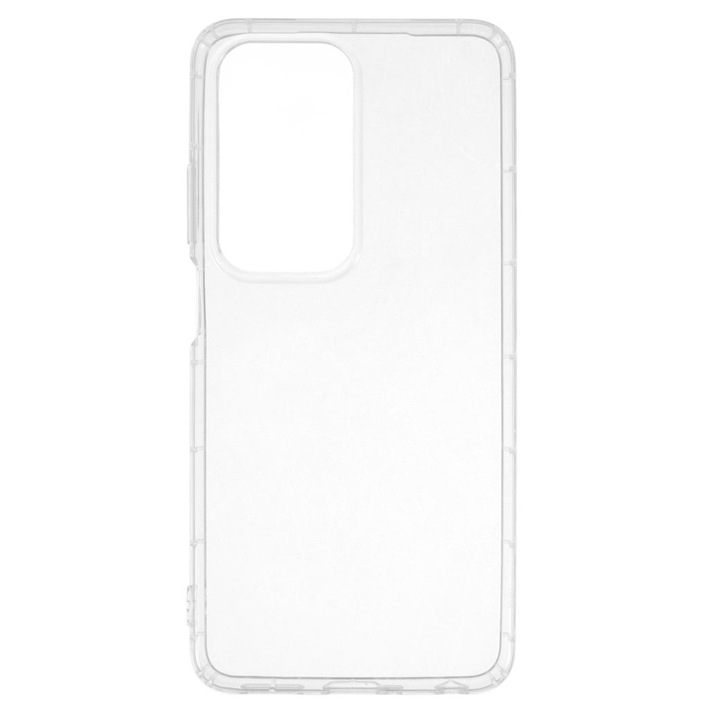 For Xiaomi Redmi A5 4G (171.7mm) Case Transparent TPU Phone Back Cover Airbag Protection