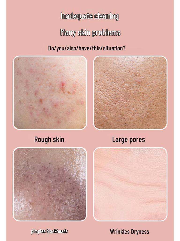 EMS Microcurrent LED Photon Skin Rejuvenation Device