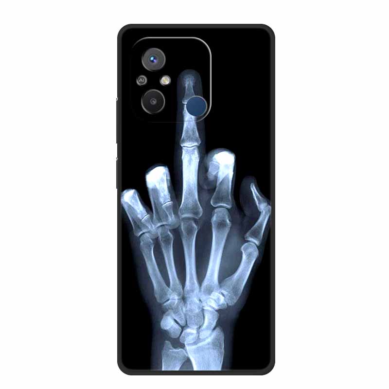 For Xiaomi Redmi 12C Case Note 12 4G 5G 12S 12Pro Plus Redmi A1 A2 Plus Soft TPU Silicone Phone Cover for Redmi Note 12 Pro Plus