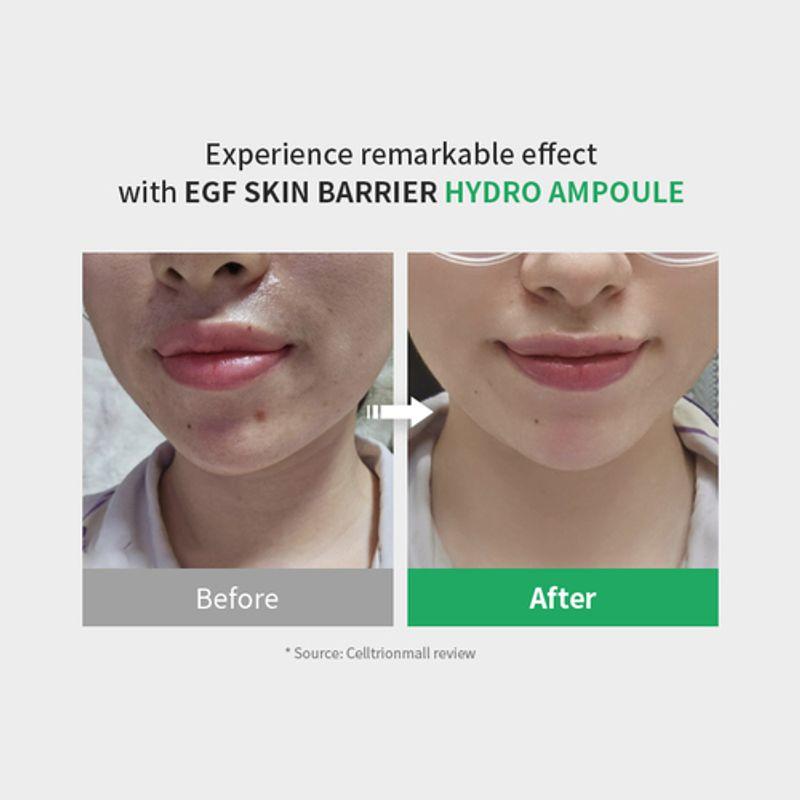 [zipiderm] EGF Skin Barrier Hydro Ampoule 30ml