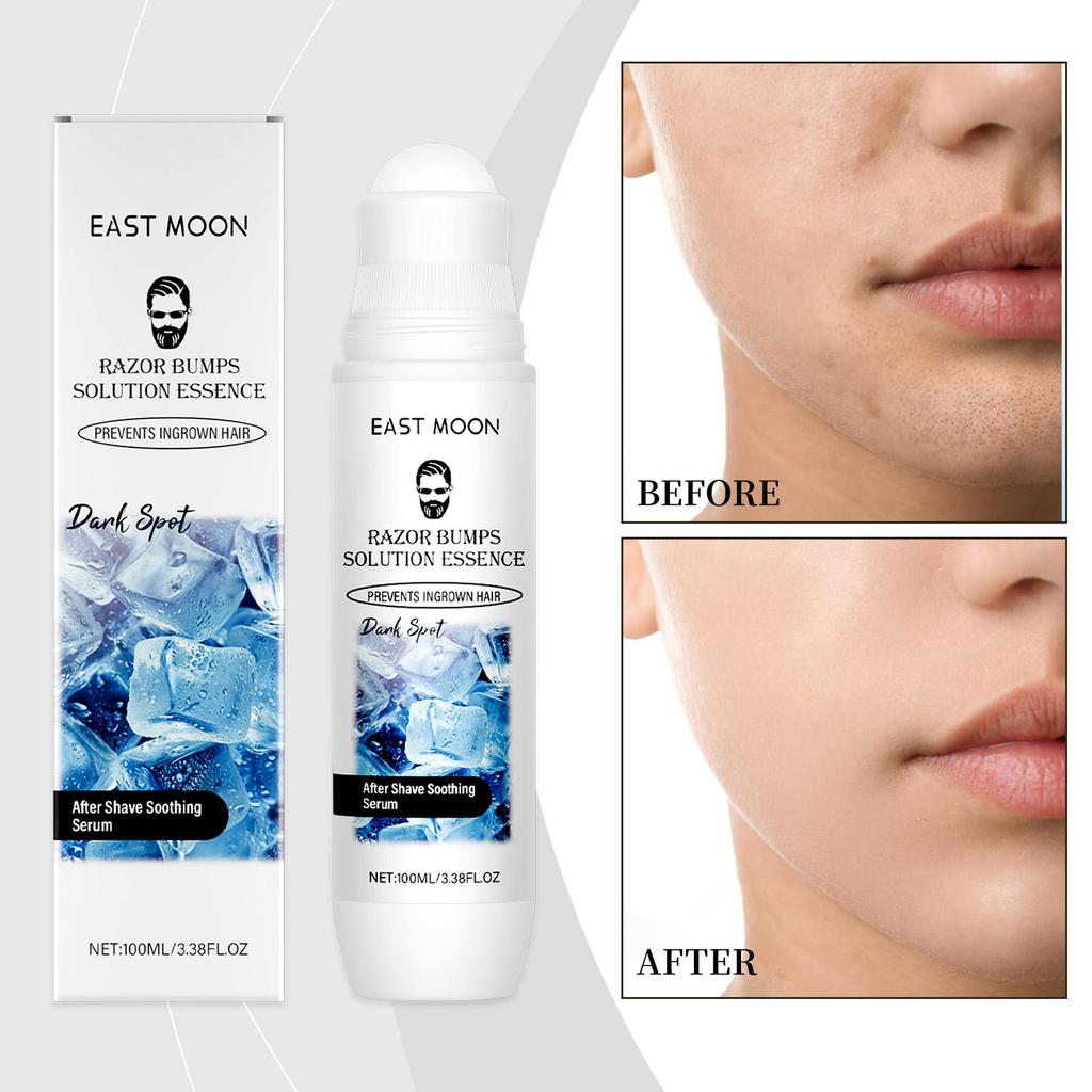 East Moon Men Aftershave Care Essence Reduce Damaged Moisturize Dry Soothing Pain Growth Inhibition Beard Remove Nourish Serums