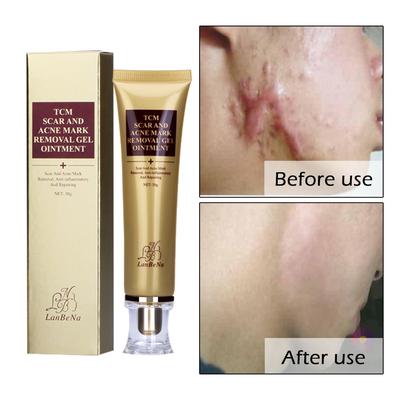 Acne Scar Removal Cream Skin Repair Face Cream Acne Spots Acne Treatment Blackhead Whitening