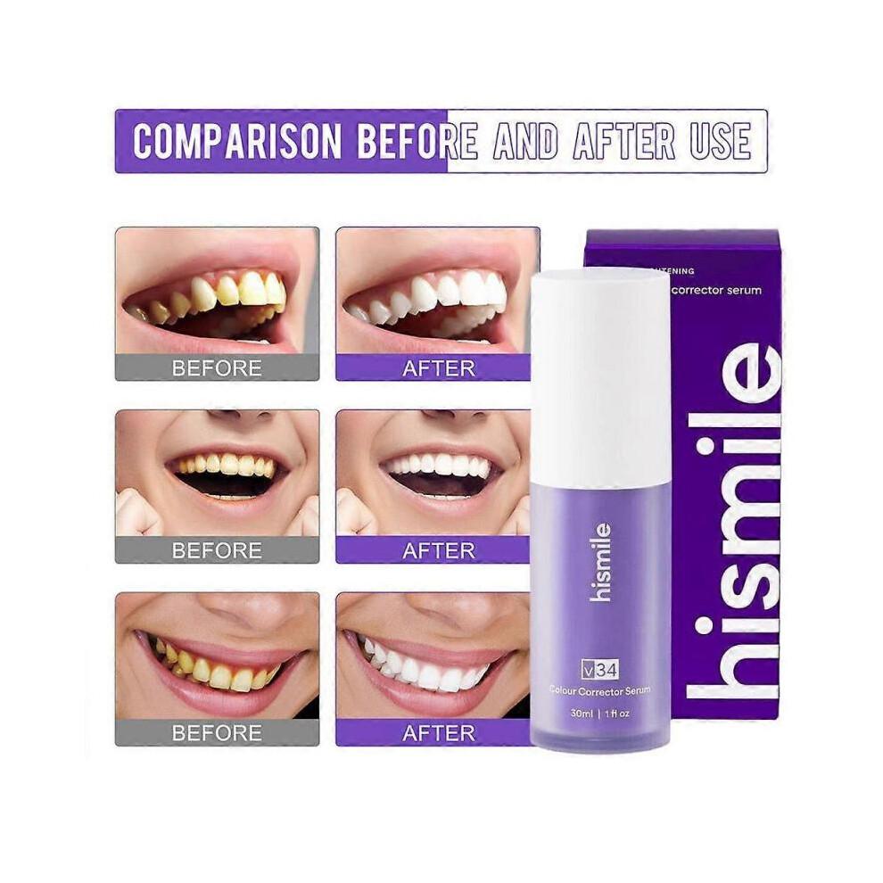Schiuma Sbiancante Correttore Colore per Denti da 30ml per Luminosità Istantanea e Alito Fresco