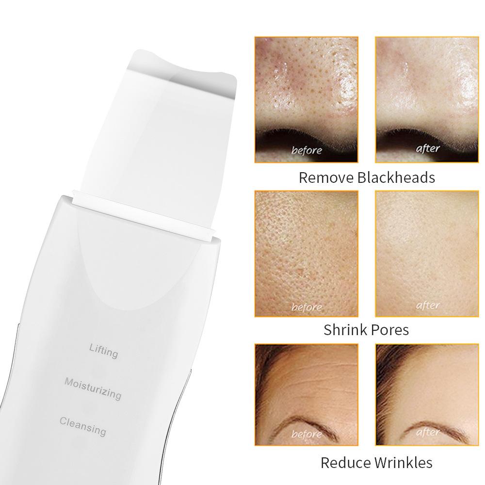 Vibration Massage Skin Scrubber Deep Face Cleaning Spatula Blackhead Remover Peeling Shovel Facial Pore Cleaner Face Lift Tool