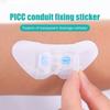 Drainage Catheter Sticker Retainer Holder Concealment Gastrostomy Tubes Fixing Tape Stabilization Catheter Leg Strap Holder