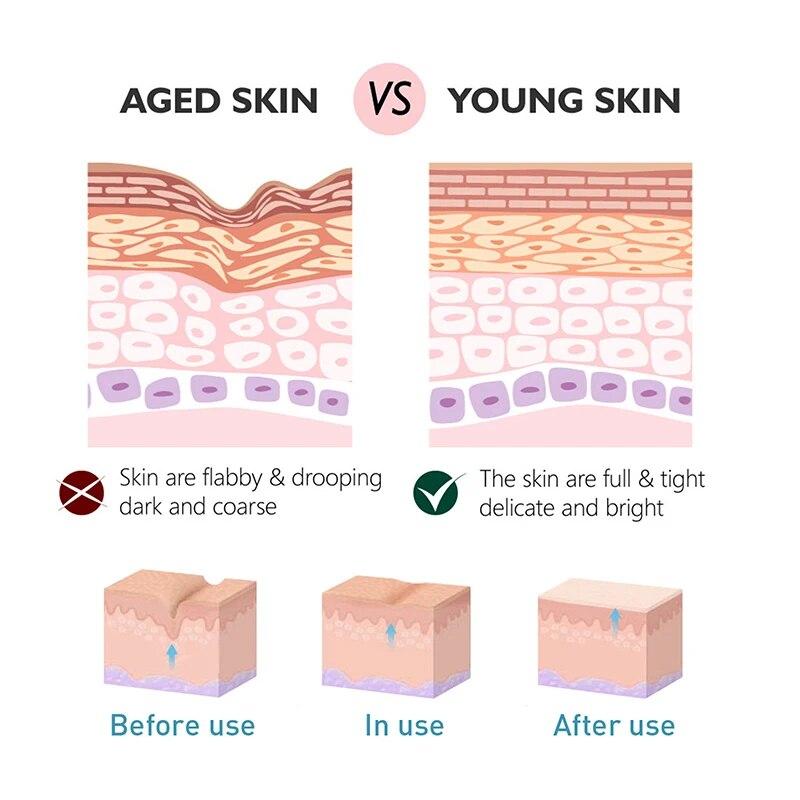 Wrinkle Removal Cream Face Remove Anti-aging Nasolabial Folds Expression Lines Wrinkles Firming Moisturizing Facial Care