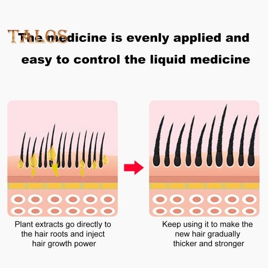 8ML Hair Oil Applicator with Precise Scale Scalp Massage Applicator Comb Clear Portable Hair Serum Oiling Dispenser Brush Hair Root Application Comb