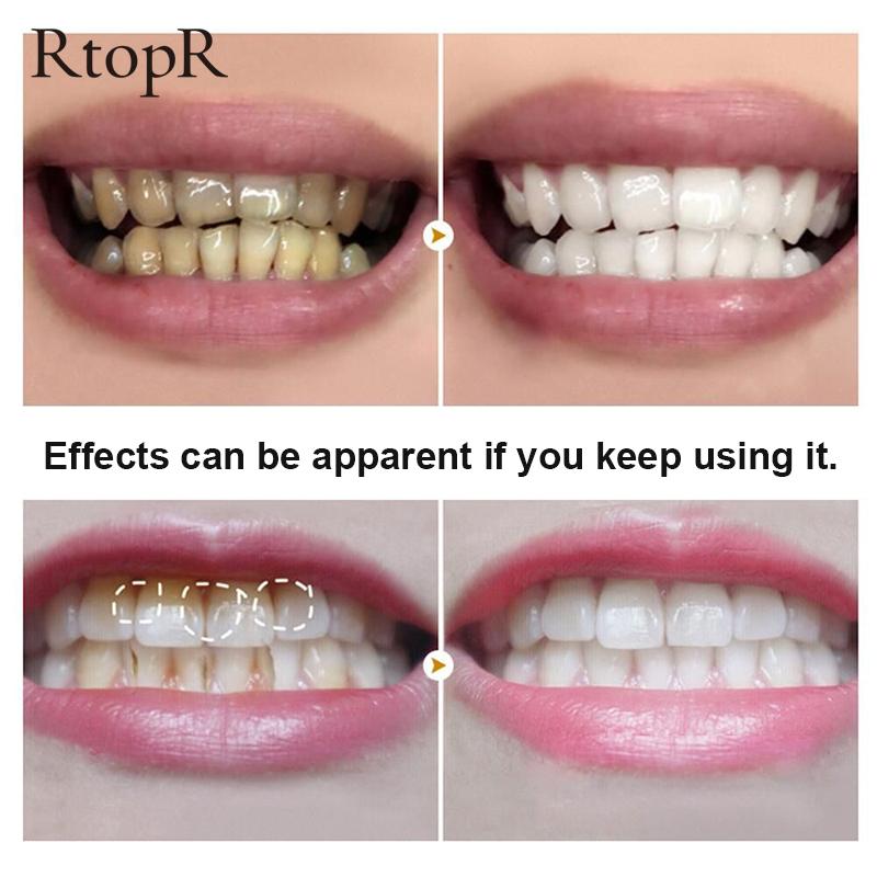 RtopR Teeth Whitening Powder Gentle Activated Mint Extract Teeth Whitening Natural Teeth Bleaching