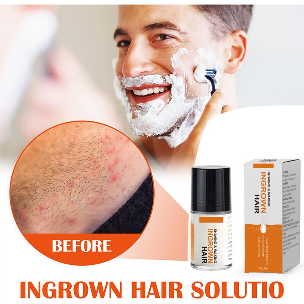 30 ml Essens-Vokser Inne i Håret, Reduserer Rødhet, Forhindrer Hår i å Vokse Innover, og Lindrer Etter Skjeggessenser