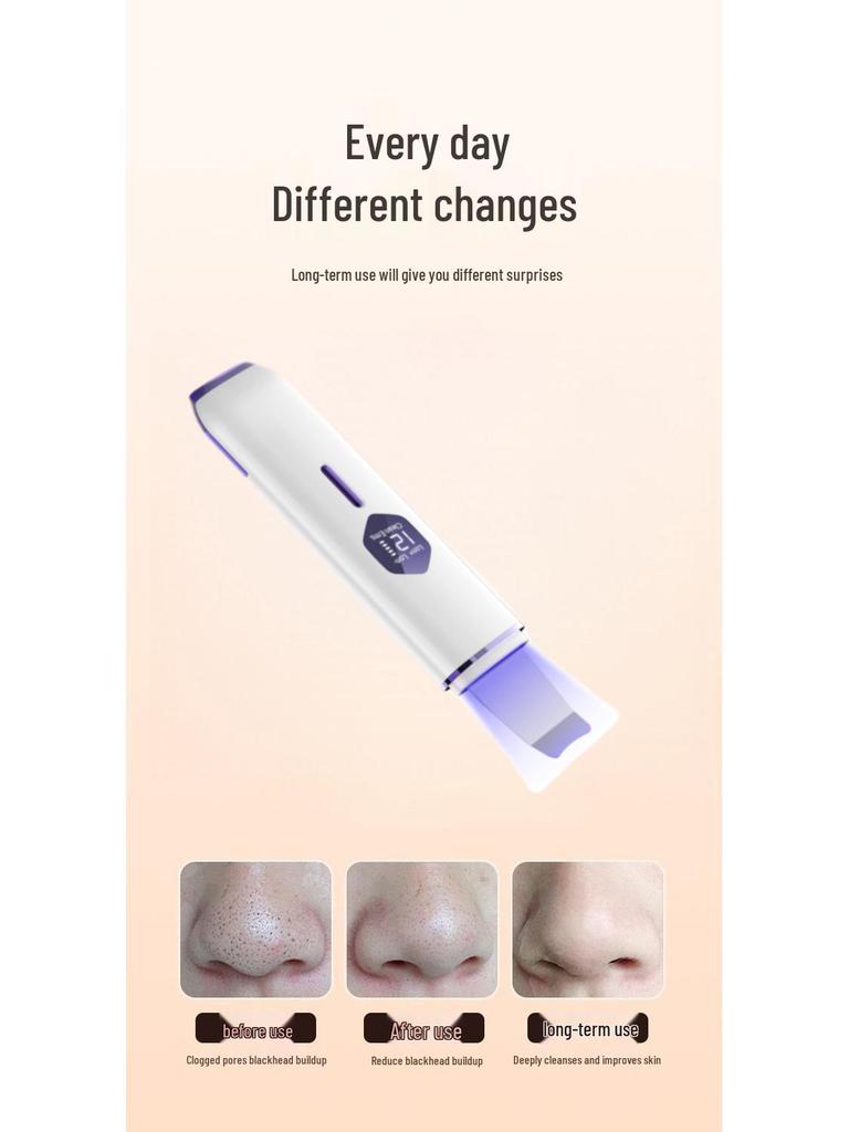 Rechargeable Ultrasonic Blackhead and Pimple Remover with EMS Skin Scraper