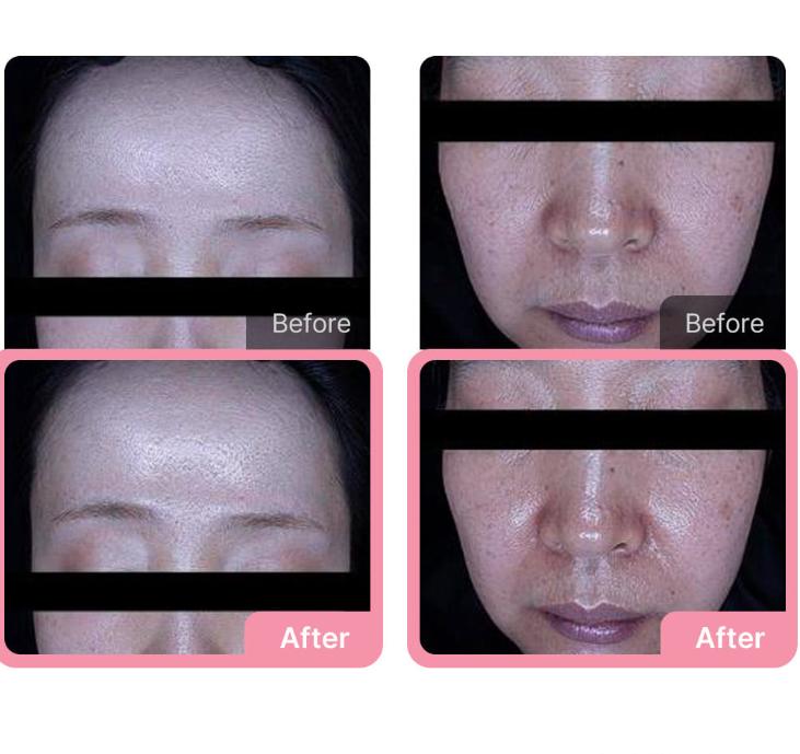 Medicube PDRN Pink Collagen Jelly Mist Serum 100ml – Stangrinantis ir drėkinantis švytėjimo purškiklis