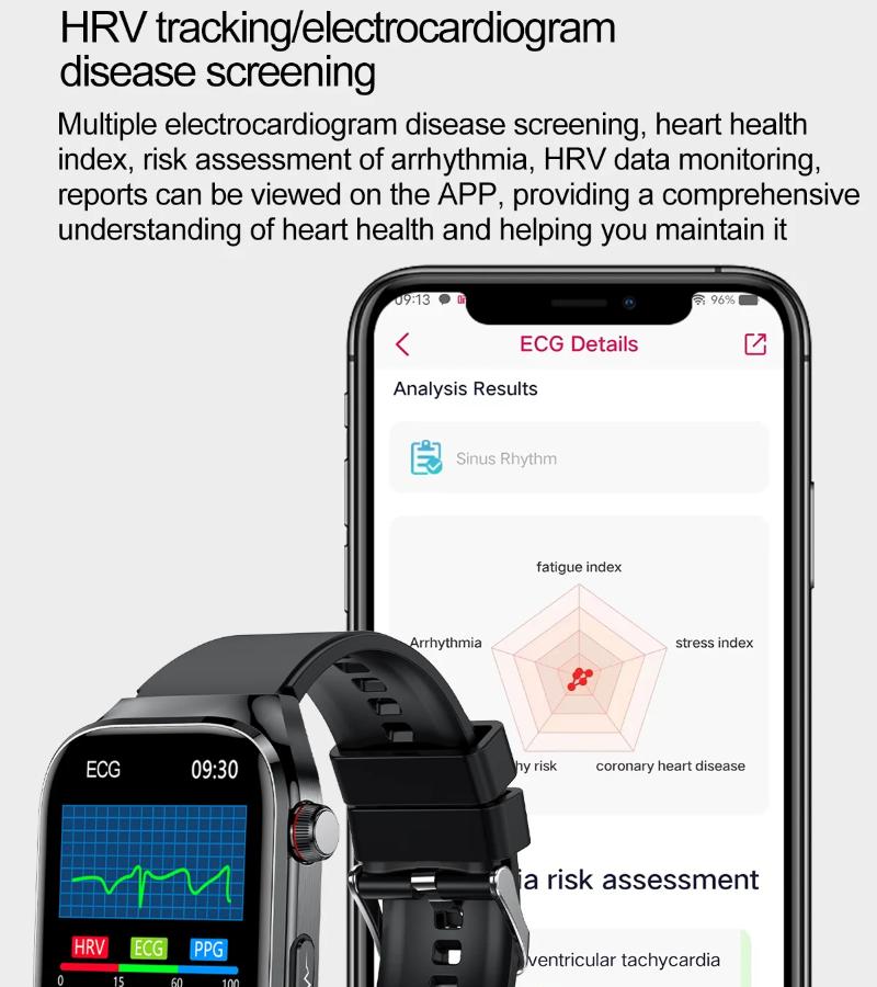 2025 Neue Mikro-Körperuntersuchung Smartwatch für Männer Harnsäure Körperfett Fünf Organe Gesundheitsuhren Bluetooth Anruf Smartarmband