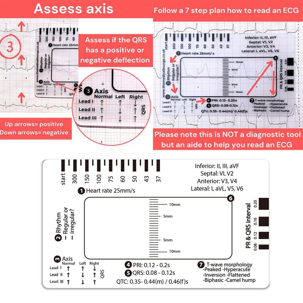 Professional ECG 7 Step Ruler Card Portable Pocket ECG Interpretation Guide Card For Accurate ECG/EKG Interpretation