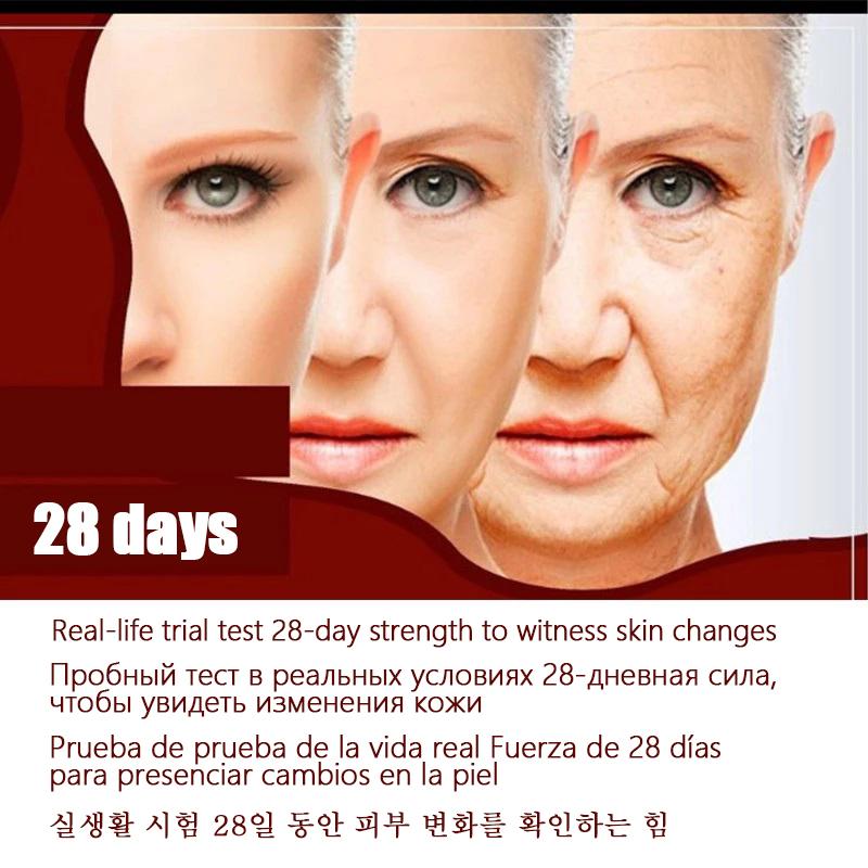 3in1 RF EMS מכשיר יופי פנים דופק מכונת פנים הרמת צוואר הסרת שקיות יופי עיניים מכונה להצערת העור