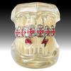 Stylish Hip Hop Grillz Set: Red Diamond Cross & Lightning Gold