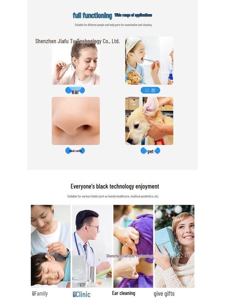 אוטוסקופ ויזואלי HD ואנדוסקופ להסרת שעוות אוזניים בגודל 4.5 אינץ'