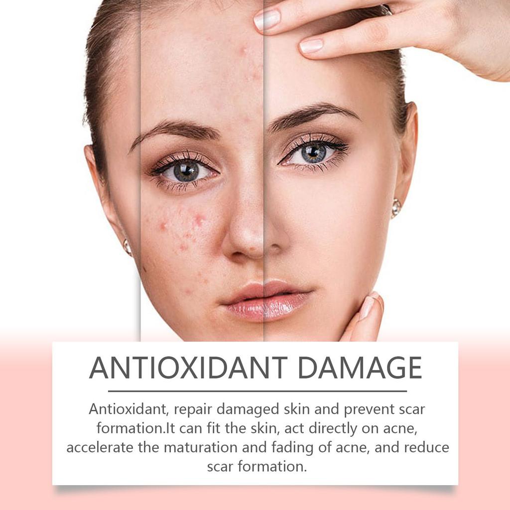 Ouhoe Acne Patches For Facial Care And Support To Reduce Blemishes And Improve Skin Appearance