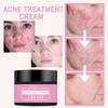 Remove Acne Mild Repair Acne Pits Acne Marks Nourishing Moisturizing Hydrating Acne Cream