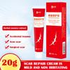 20 г крем для удаления шрамов от акне, хирургическое удаление растяжек, гель для кожи лица, отбеливающий пигментацию тела, Sm U4P9