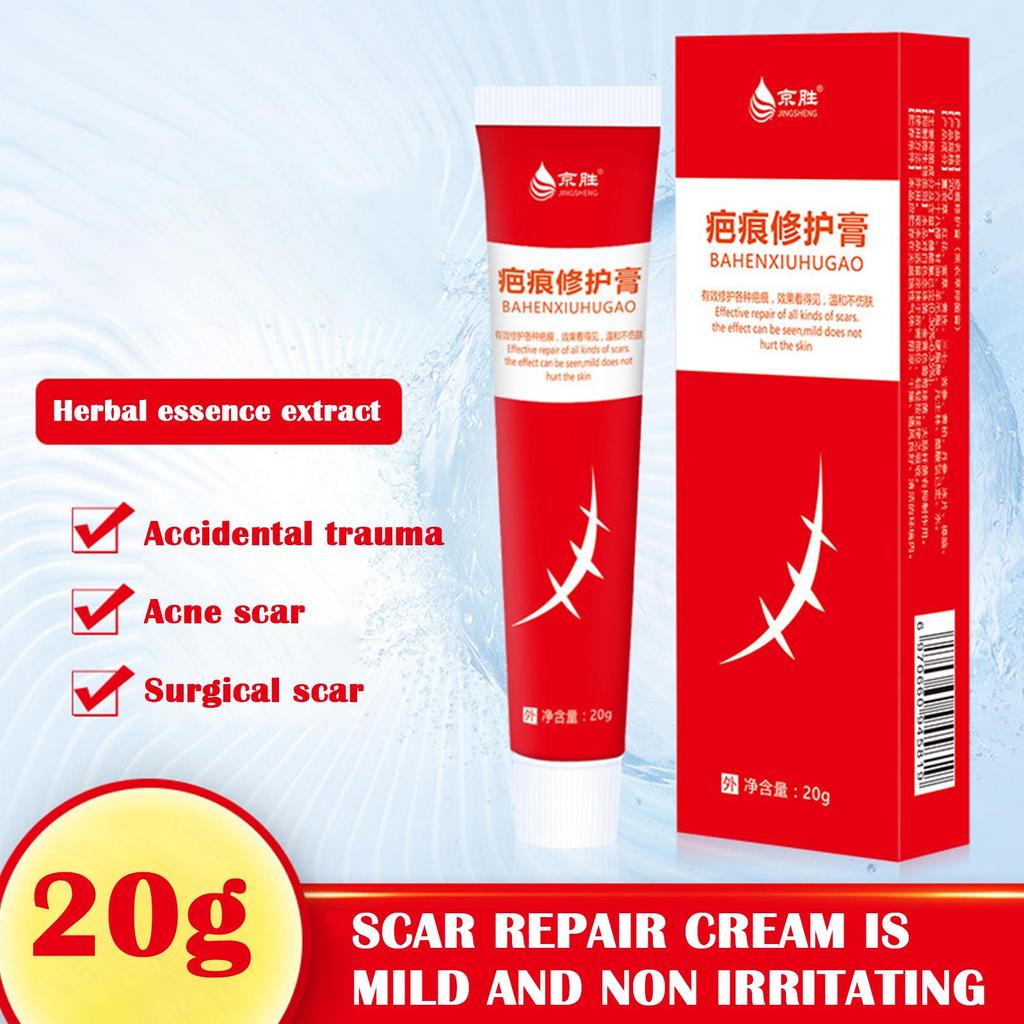20 г крем для удаления шрамов от акне, хирургическое удаление растяжек, гель для кожи лица, отбеливающий пигментацию тела, Sm U4P9