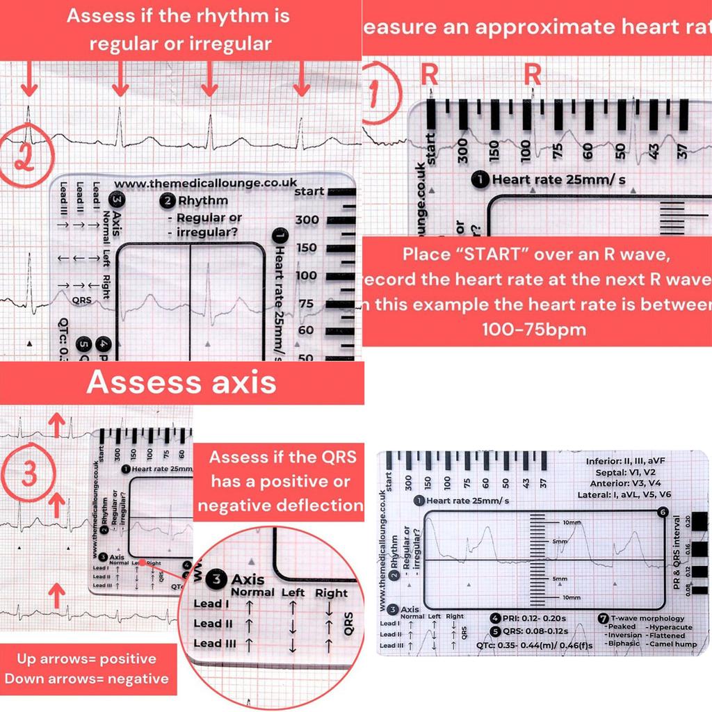 Portable ECG EKG 7 Step Ruler Card ECG/EKG Interpretation Tool For Easy ECG EKG Interpretation Heart Health Assessment