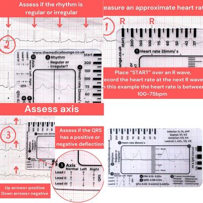 Tragbares EKG-/EKG-Interpretationstool mit 7 Schritten, EKG-/EKG-Interpretationstool für eine einfache EKG-/EKG-Interpretation, Beurteilung der Herzgesundheit