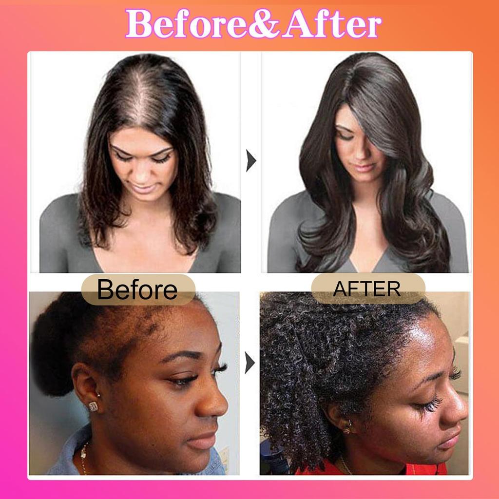 Aceite de Batana de Botanix para el crecimiento del cabello, aceite de Batana natural para el crecimiento del cabello de Botanix, aceite de Batana sin refinar, para hombres y mujeres