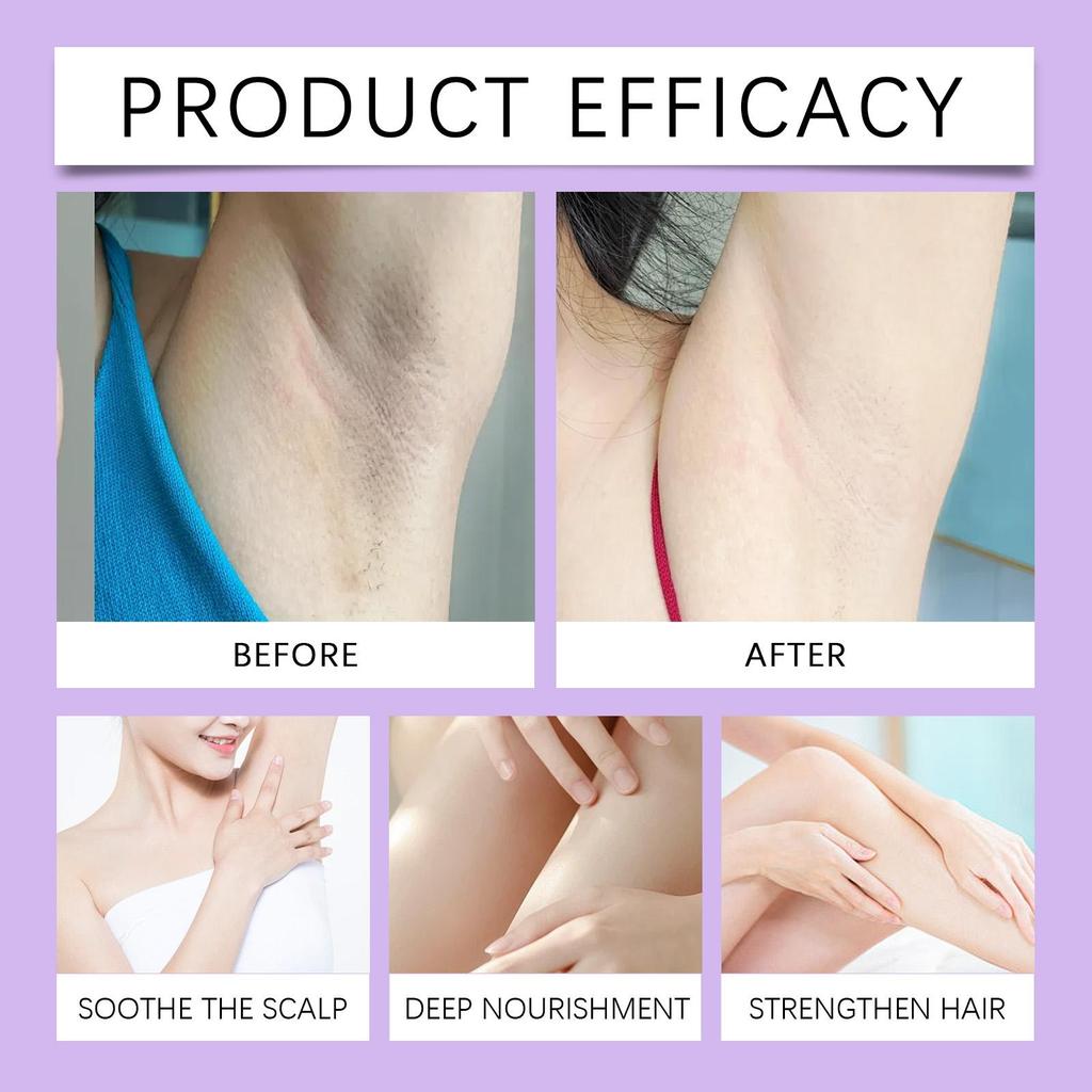 OceAura Hair Removal After Shave Oil Specially designed to reduce hair regrowth No black spots left behind  60ml
