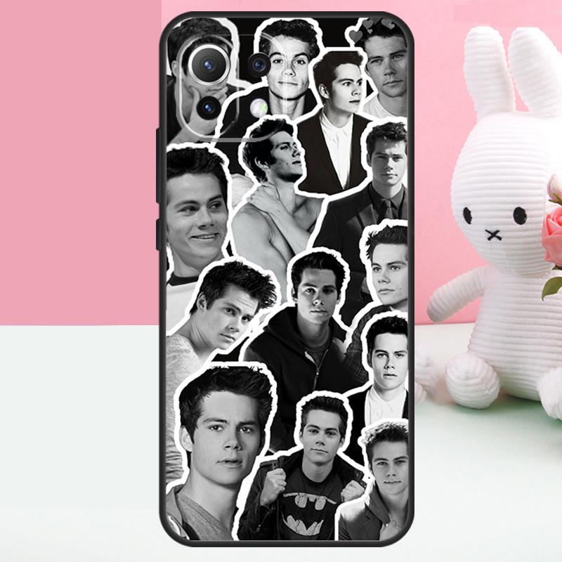 

Dylan O Brien Collage Teen Wolf Case For Xiaomi 15T 13T 14T 17 Pro Max 15 14 Ultra POCO X7 Pro X5 X6 F5 F6 F7 F8 Ultra Funda POCO F6